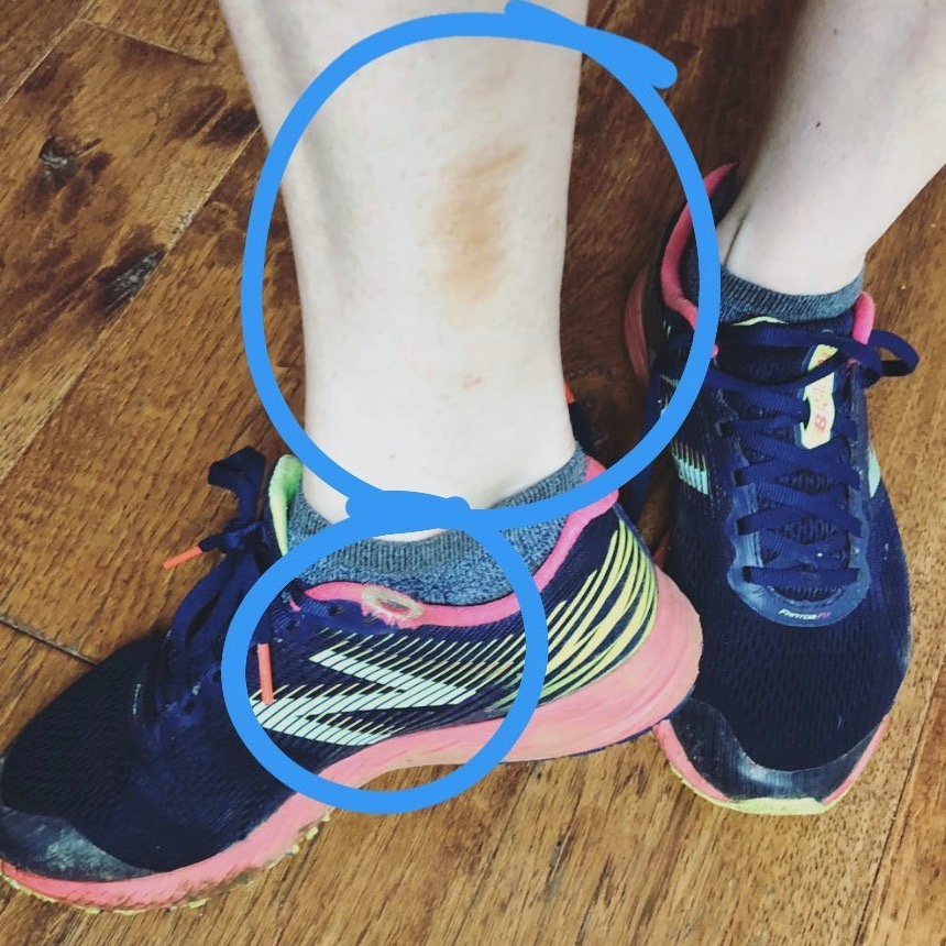 Why Are You Kicking Yourself?