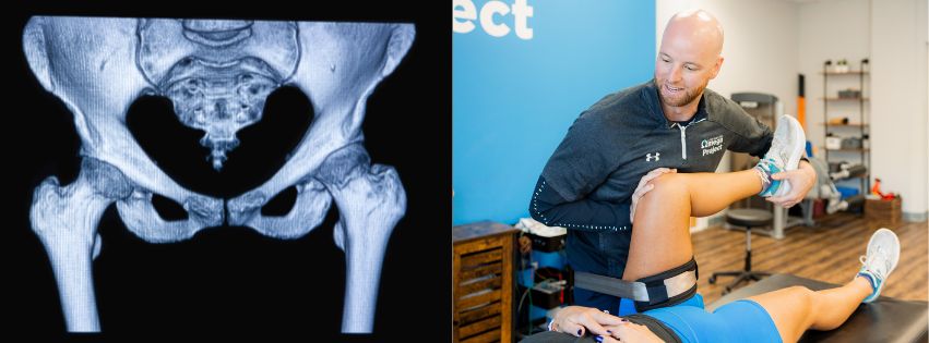 physical therapy, hip pain, knee pain, back pain